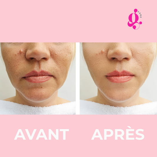 Masseur raffermissant - Technologie Anti-Âge