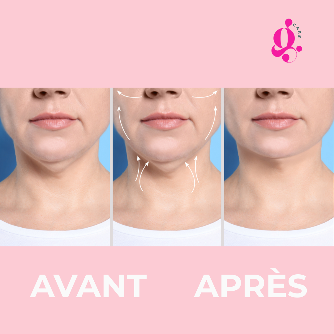 Gua Sha Électrique - Massage Liftant