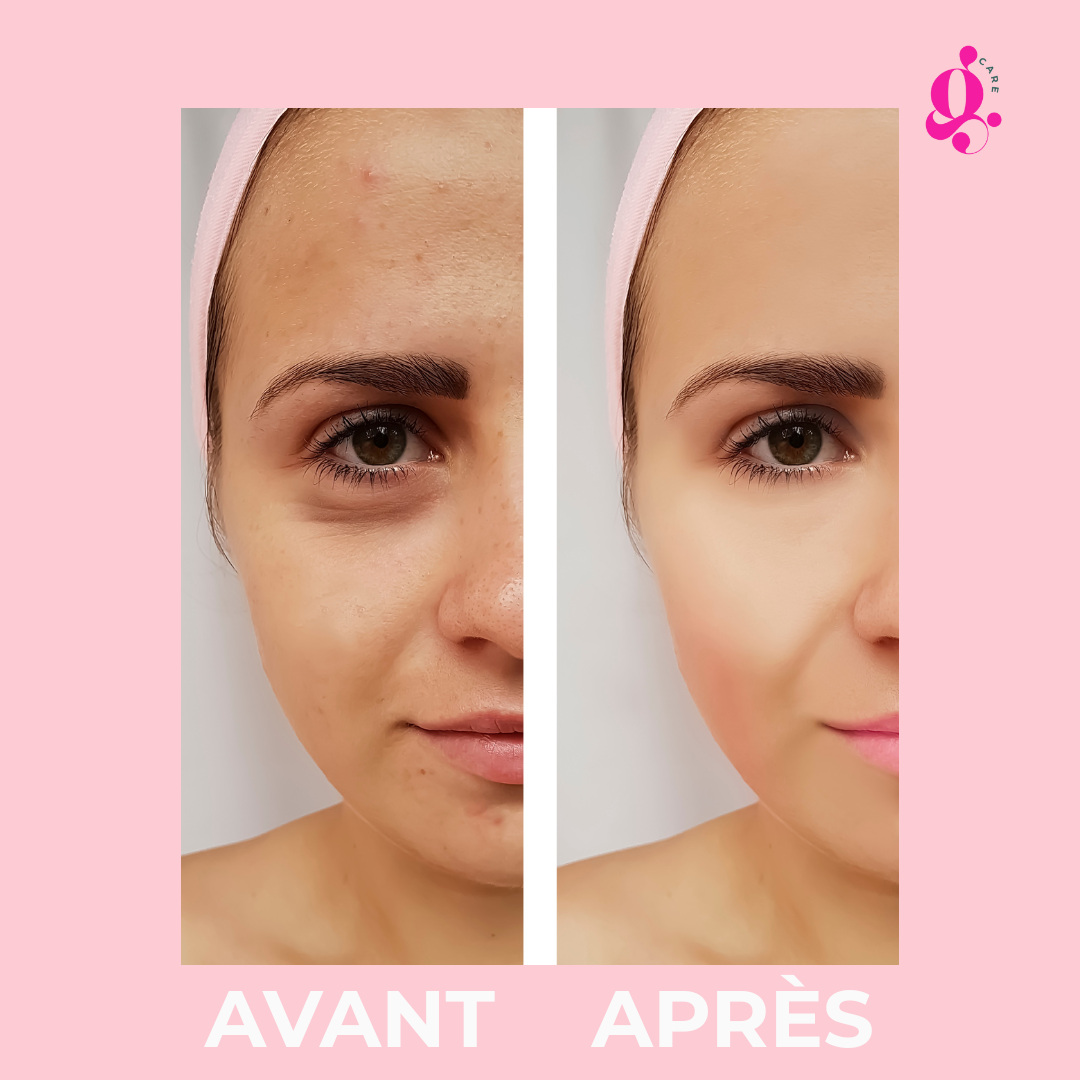 Nettoyant Visage Sonique en Silicone - Éclat Naturel & douceur